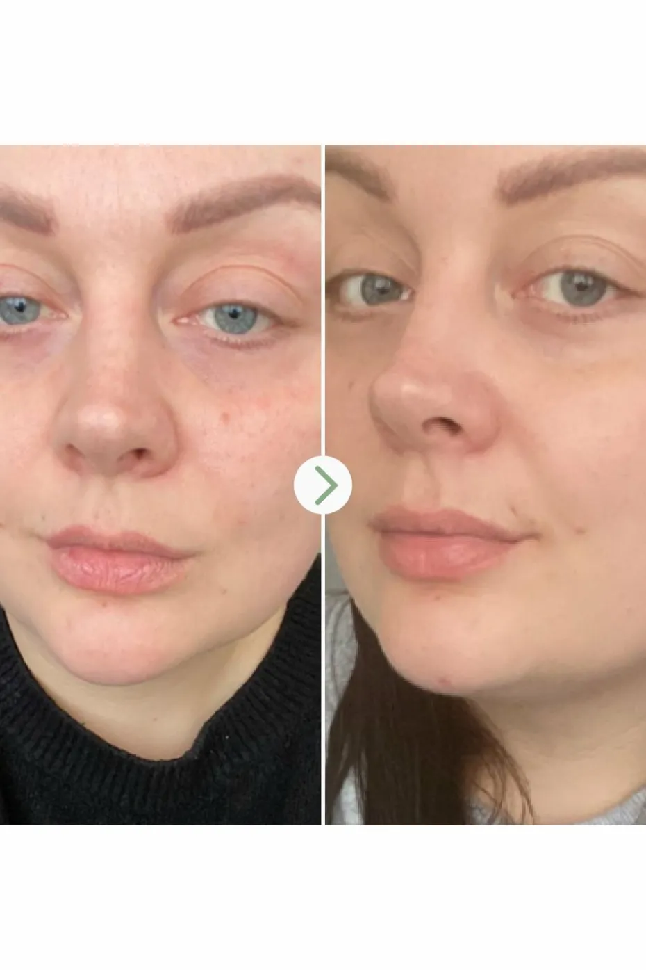 Huile visage universelle Rosehip BioRegenerate