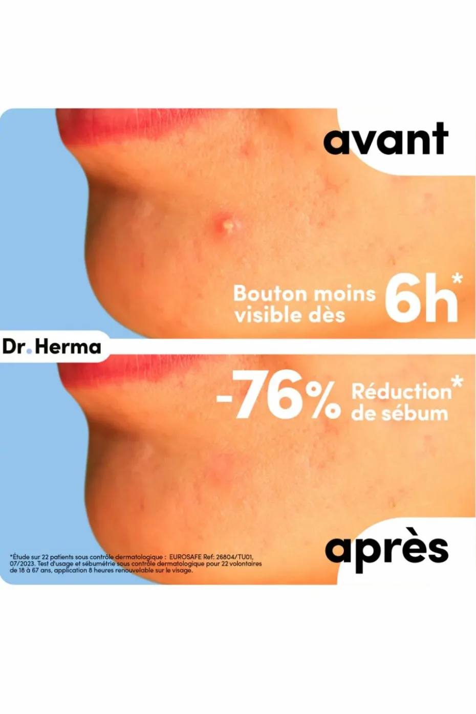 Patch anti-boutons format petit