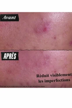 Pâte Anti-Imperfections 3-en-1