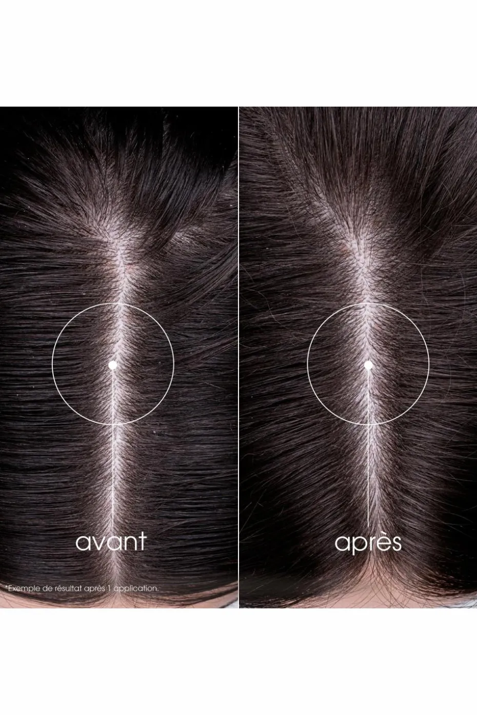 Shampoing fortifiant à la Quinine & Edelweiss bio