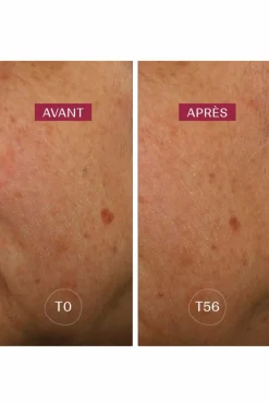 Sérum anti-taches