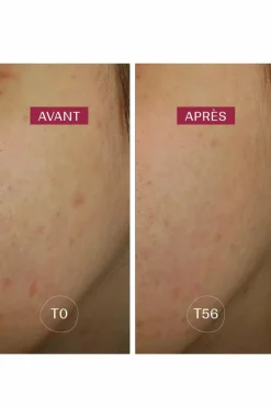 Sérum anti-taches