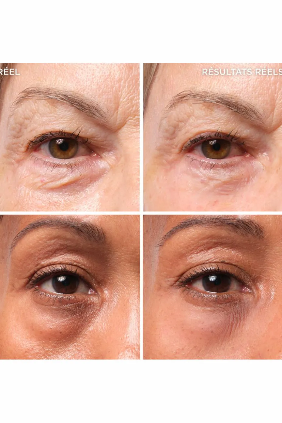Traitement pour les poches Bye Bye Under Eye Bags